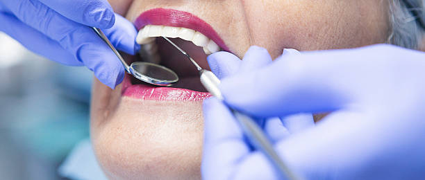 Best Dental Abscess Treatment in Oak Hills, CA
